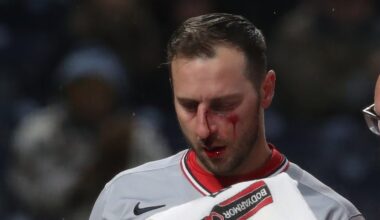 Nationals All-Star talks being hit in face