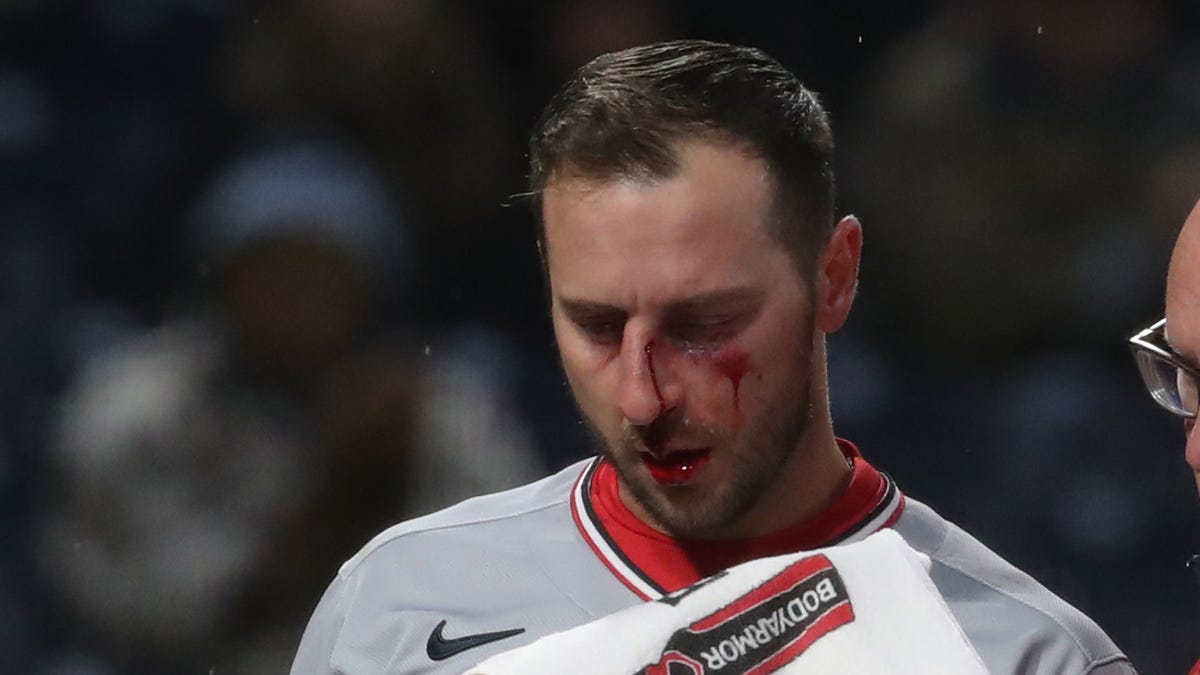 Nationals All-Star talks being hit in face