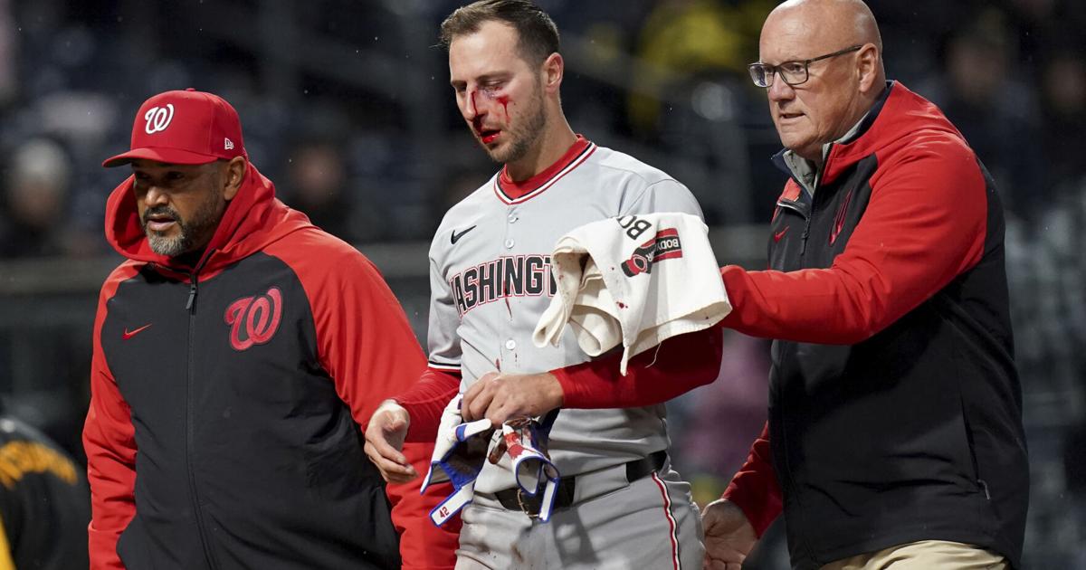 Nats' Paul DeJong relieved his vision wasn't affected by pitch to face that broke multiple bones | MLB