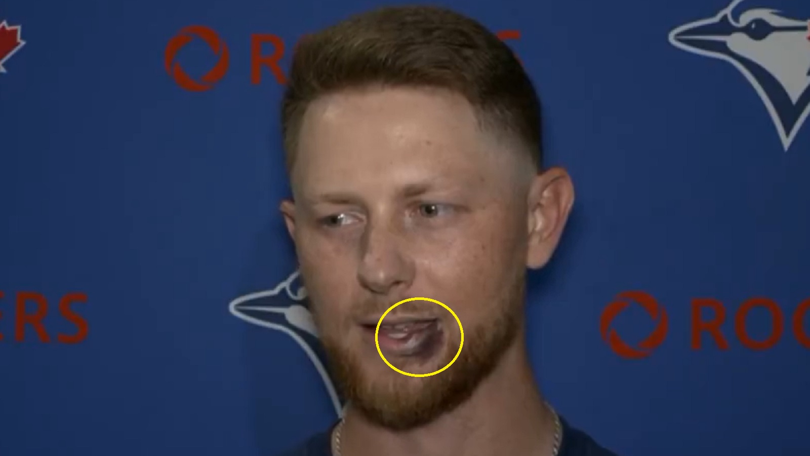 Eric Lauer tells a story about Max Scherzer to explain his fat lip