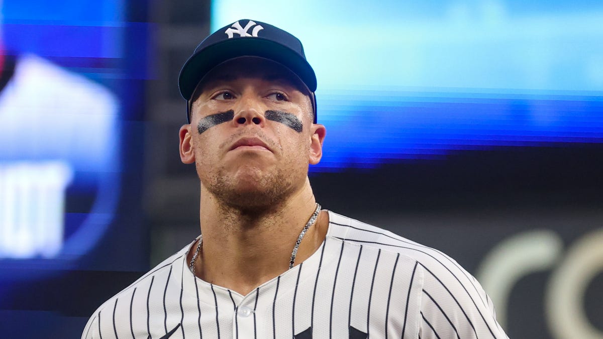 Yankees star out with 'elbow issue'