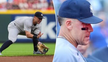 Yankees' Aaron Judge bloodied after getting hit by Anthony Volpe throw