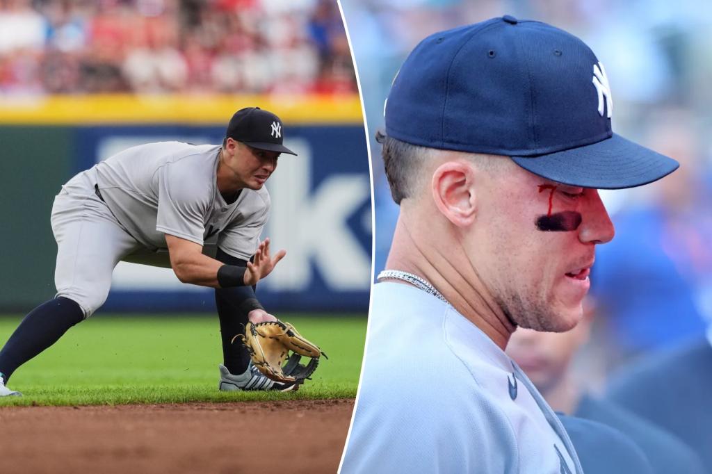 Yankees' Aaron Judge bloodied after getting hit by Anthony Volpe throw
