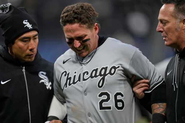 Chicago White Sox's Korey Lee grimaces as he is helped off the field after injuring himself at first base in the sixth inning of a baseball game against the Cleveland Guardians in Cleveland, Wednesday, April 9, 2025. (AP Photo/Sue Ogrocki)