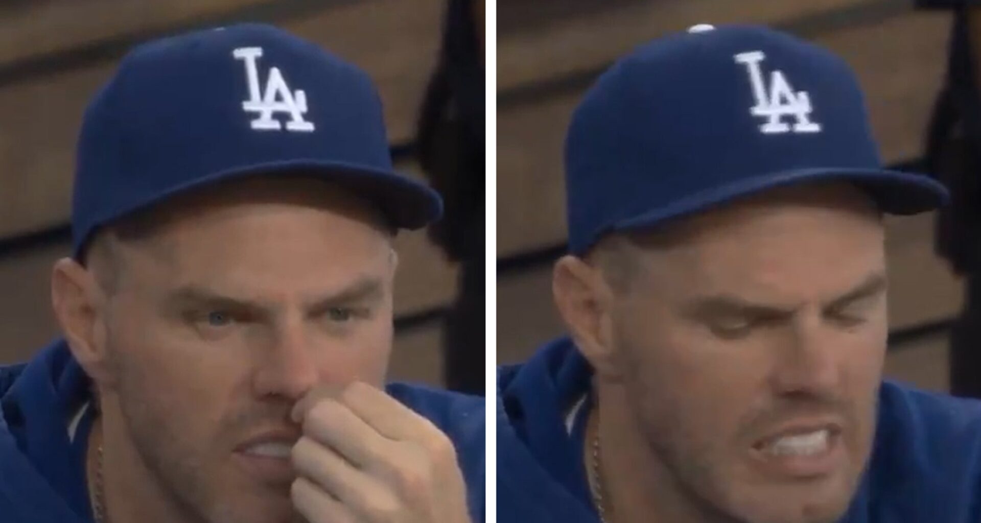Freddie Freeman Caught On Dodgers Broadcast Ripping Out Nose Hair
