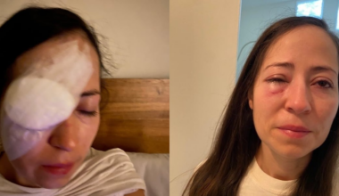 Atlanta Braves may be liable for damages from fan’s 2021 World Series injury, appeals court rules