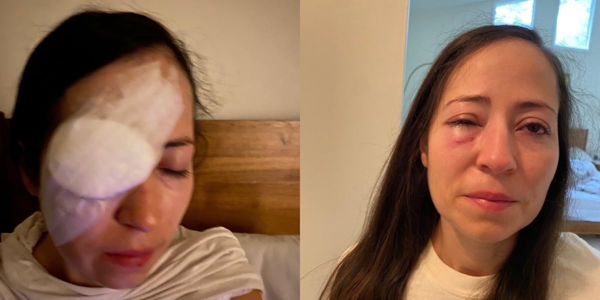 Atlanta Braves may be liable for damages from fan’s 2021 World Series injury, appeals court rules