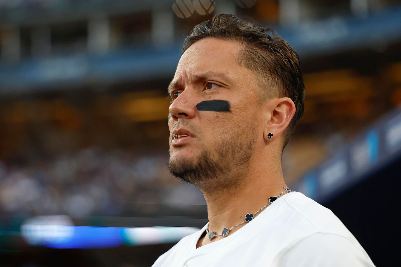 Dodgers Star Sends 3-Word Message After Trump Order Separates Family