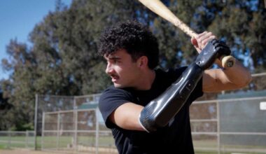 Player with bionic hand returns to baseball after losing hand in firework accident