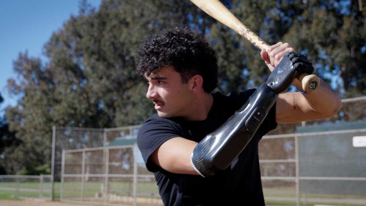 Player with bionic hand returns to baseball after losing hand in firework accident