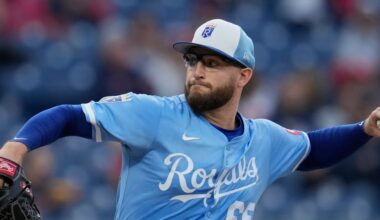 Cameron to miss start due to back tightness