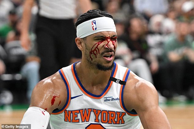 Josh Hart was left bloodied and bruised after being caught by Luke Cornet's elbow