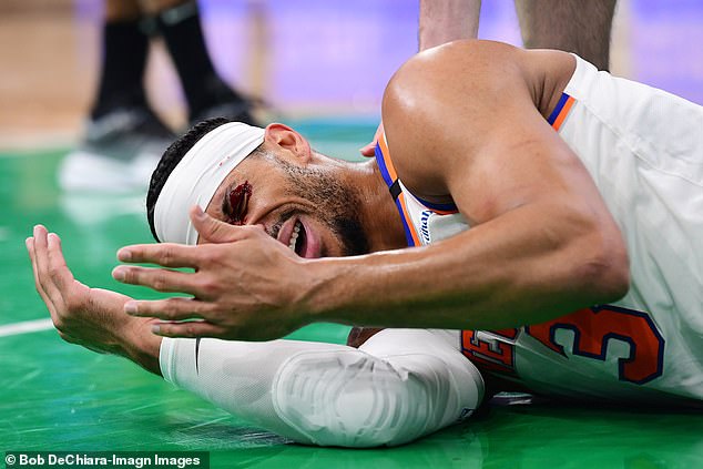 He immediately fell to the court and blood began gushing from a cut between his eyes