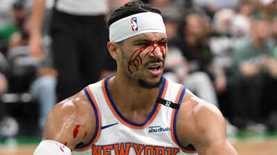 Josh Hart left bloodied and bruised in New York Knicks vs Boston Celtics Game 5