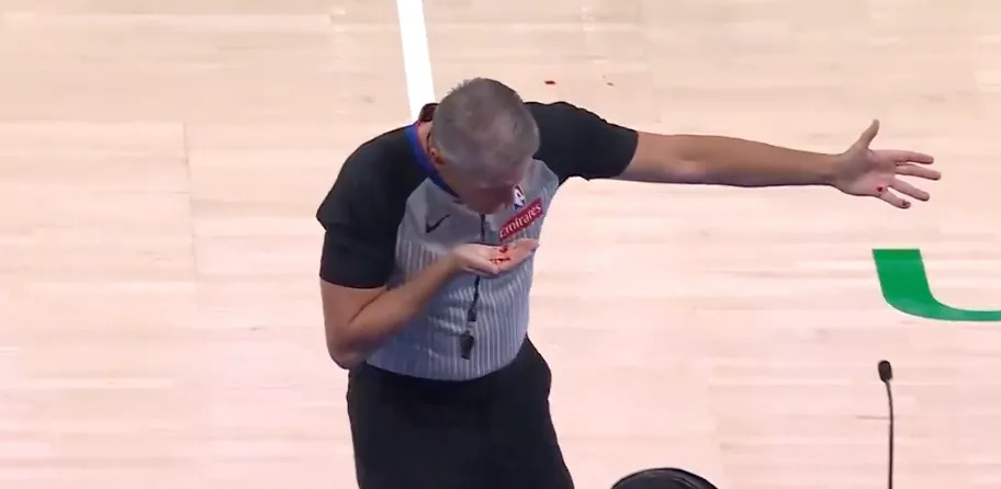 Scott Foster was bloodied on the kick ball in Game 2 of the Western Conference finals.