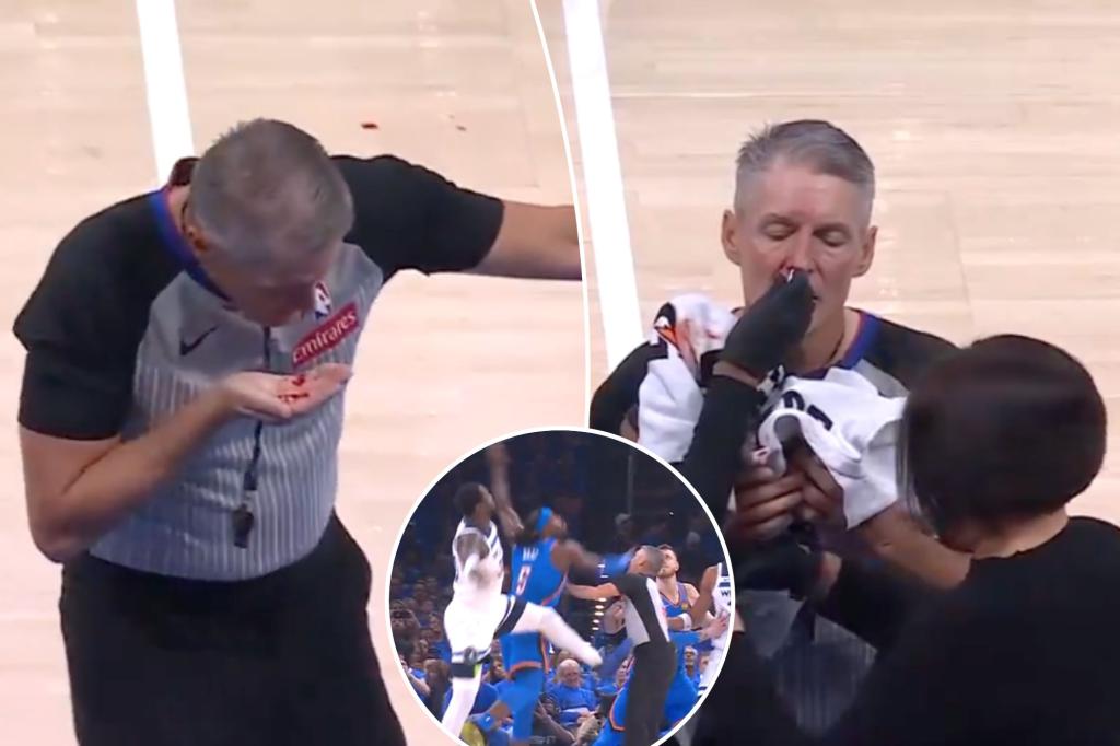 NBA ref Scott Foster bloodied after getting smacked in face