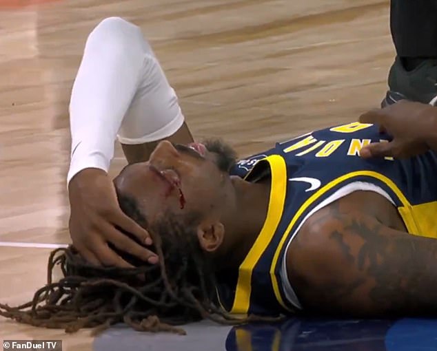 Wright soon had blood pouring from a cut on his face and medics rushed to his aid on court