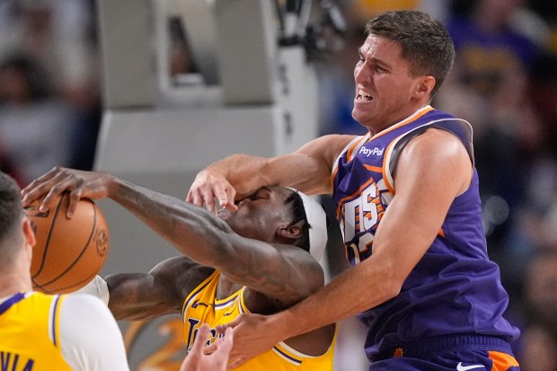 Lakers forward Jarred Vanderbilt, left, is hit in the face...