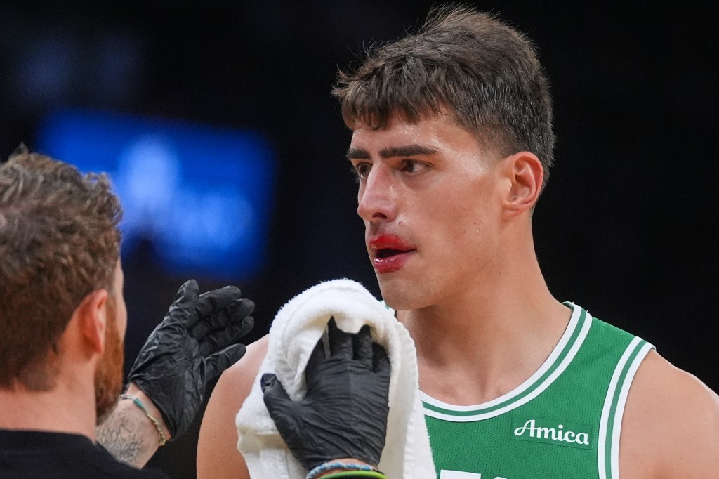 Celtics big man ruled out for Knicks matchup with concussion