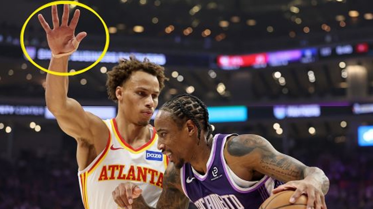 Dyson Daniels injury, taped hand, reason for less shots, stats, Atlanta Hawks vs Utah Jazz, video, highlights, Tyrese Proctor