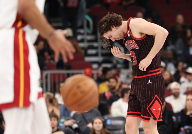 Bulls guard Josh Giddey checks for blood after getting hit in the face by Heat forward Keshad Johnson in the fourth quarter at the United Center on Nov. 21, 2025, in Chicago. (John J. Kim/Chicago Tribune)