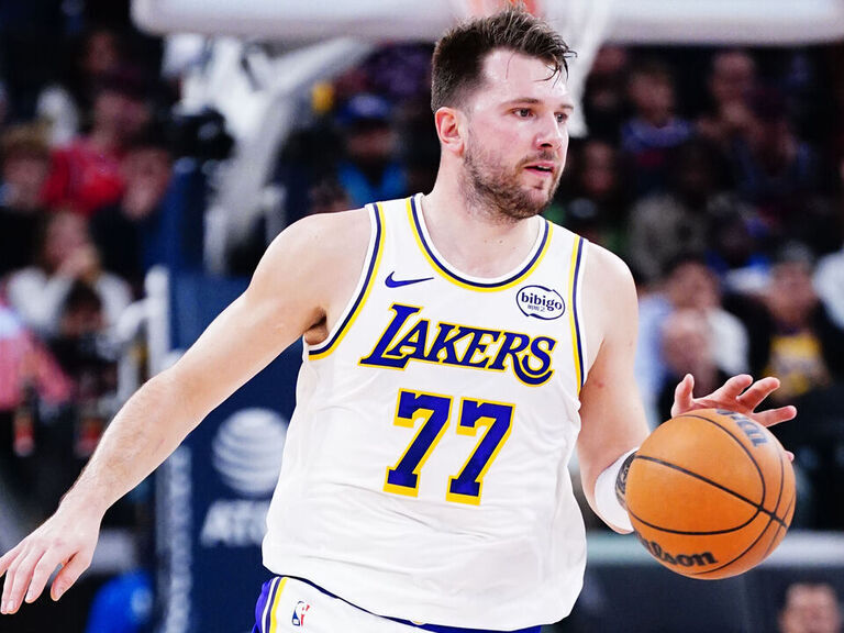 Luka day-to-day with calf contusion