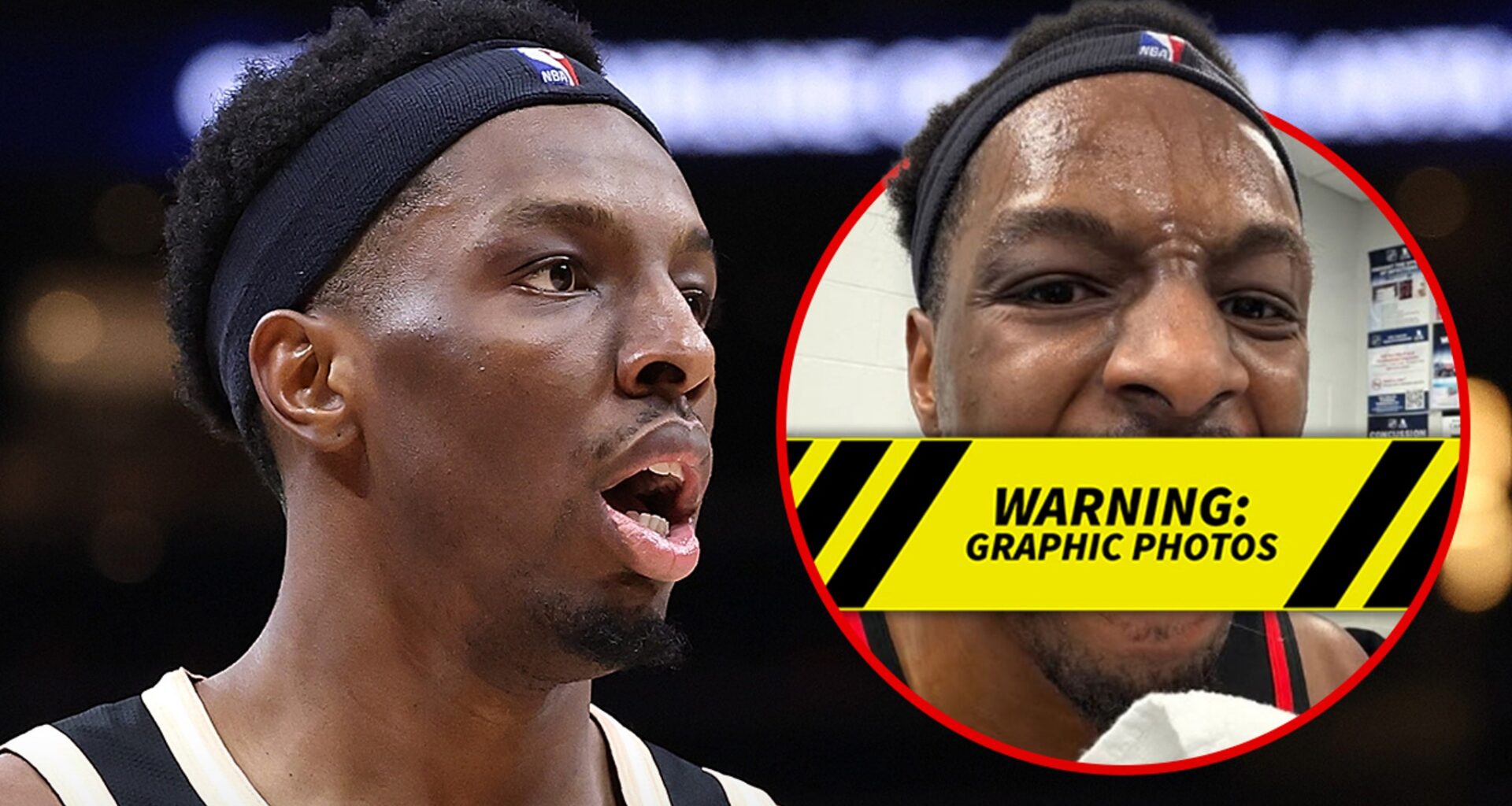 Hawks' Onyeka Okongwu Elbowed In Face By Jaylen Brown, Teeth Knocked Out