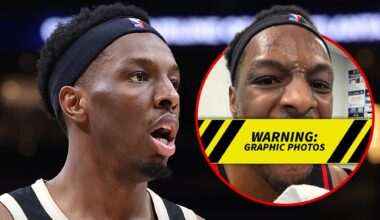 Hawks' Onyeka Okongwu Elbowed In Face By Jaylen Brown, Teeth Knocked Out