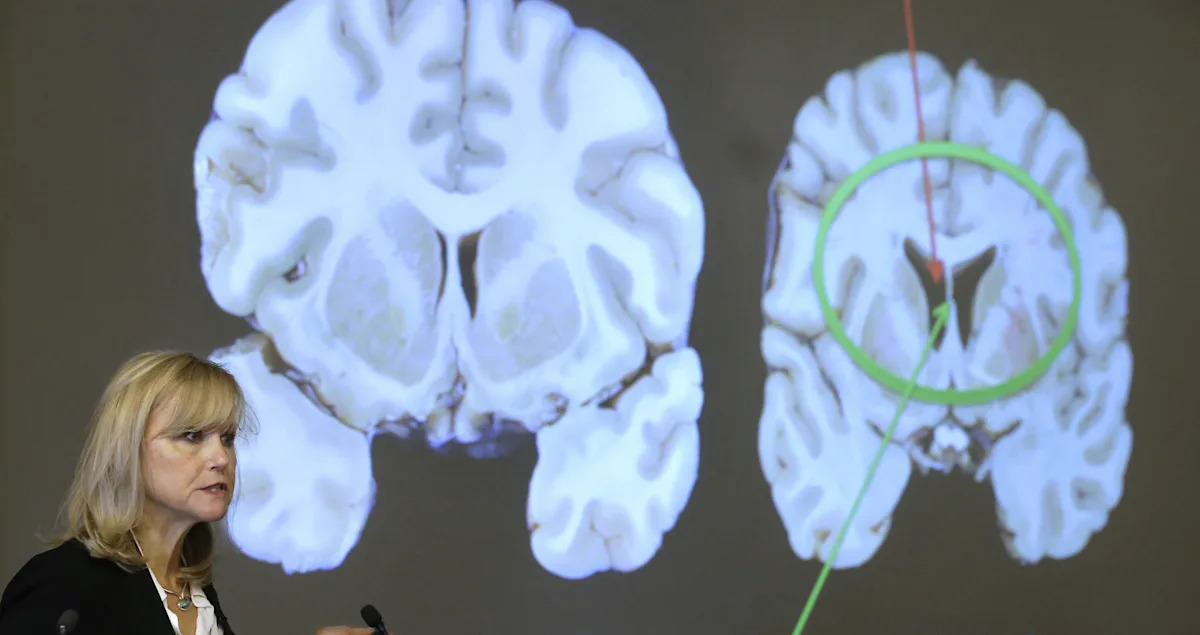 NYC shooter mentioned CTE, accused NFL of concealing its dangers in note. What is it and why does it impact so many football players?