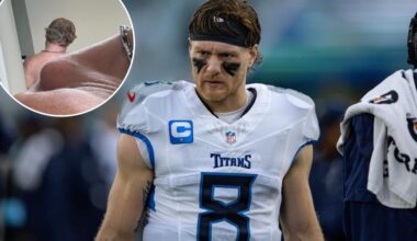 Titans QB Will Levis shares gruesome photo of shoulder before surgery