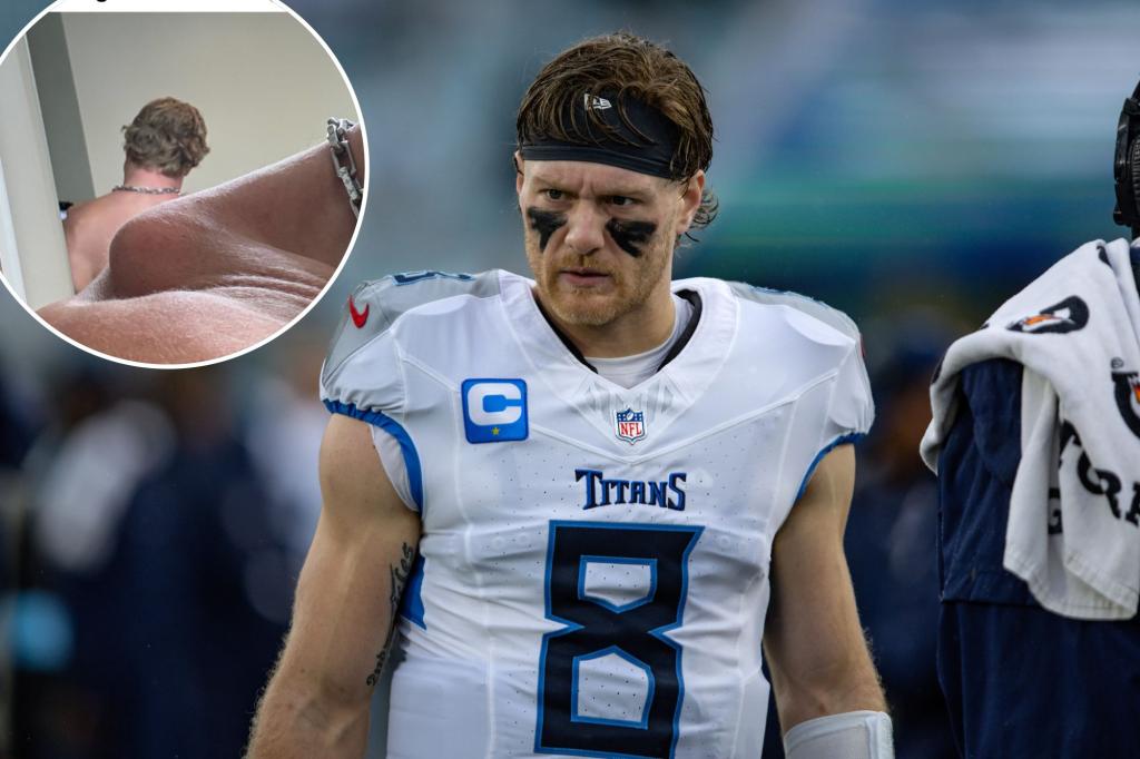Titans QB Will Levis shares gruesome photo of shoulder before surgery