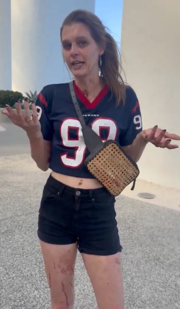 The fan was still covered in blood after the fight. @pahrduve/X