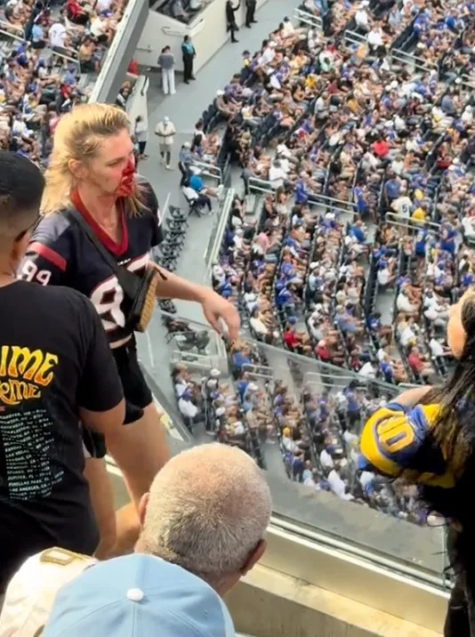 The Texans fan is bloodied after the spat. @brian.bowie43/TikTok