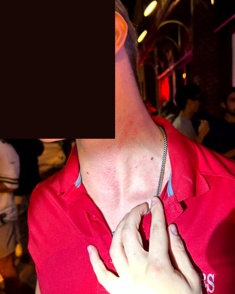 Photo taken by Eau Claire Police of a bar employee allegedly assaulted by Don Majkowski.