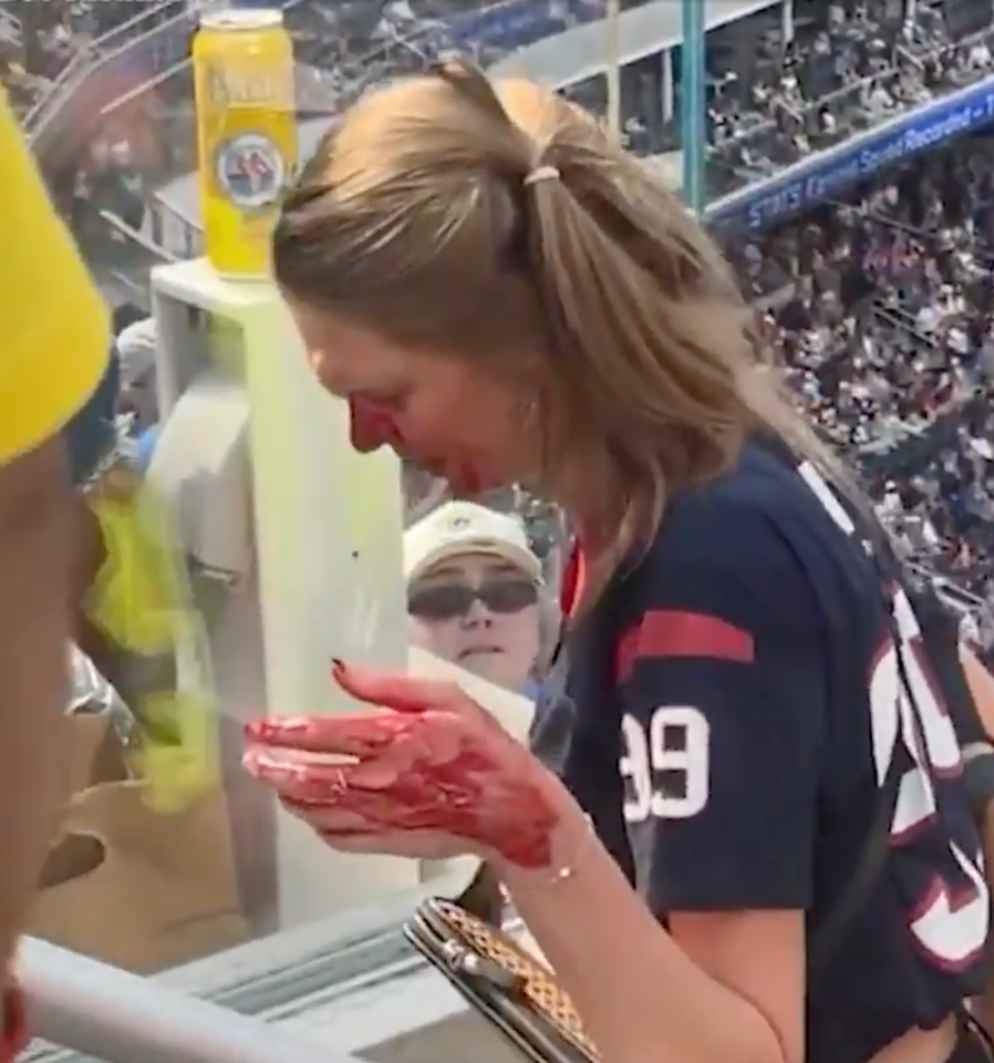 Woman with blood on her hands and face at a sporting event.