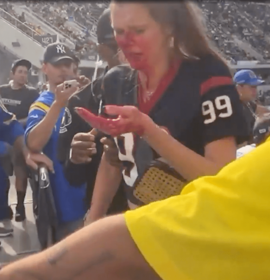 Woman with blood on her face and hand at a sporting event.