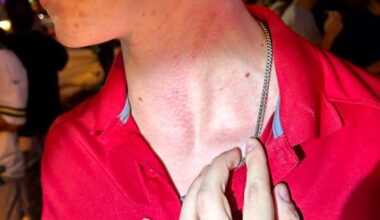 Former Packers QB accused of choking Eau Claire bartender