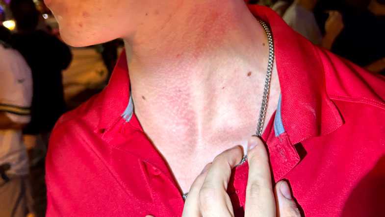 Former Packers QB accused of choking Eau Claire bartender