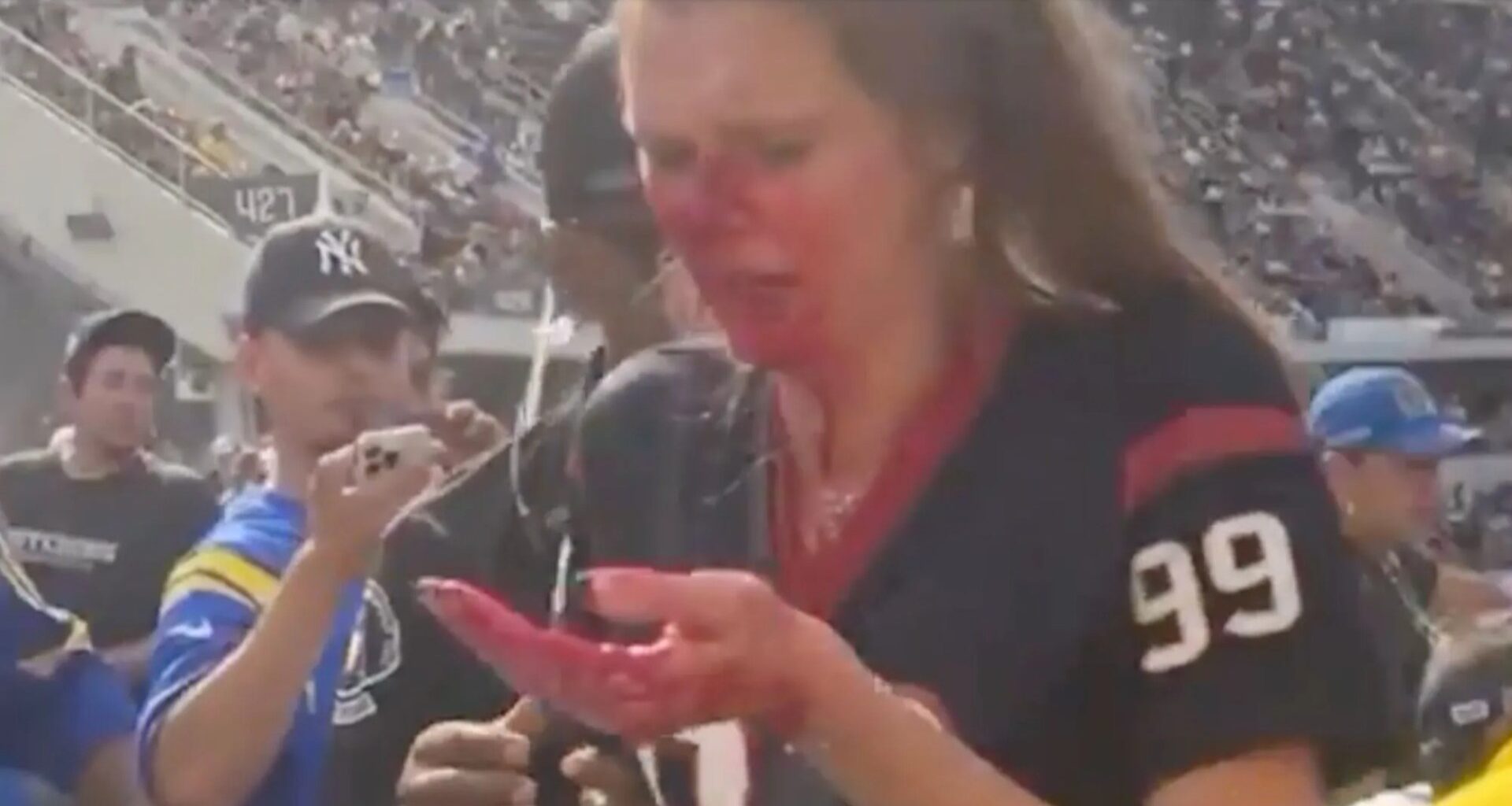 Female NFL fan left with face covered in blood after huge fight at Texans-Rams game overshadows Week 1