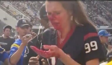 Female NFL fan left with face covered in blood after huge fight at Texans-Rams game overshadows Week 1