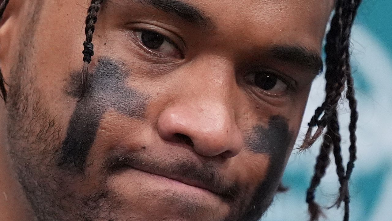 Miami Dolphins quarterback Tua Tagovailoa spoke at a news conference after the Los Angeles Chargers defeated the Dolphins 29-27 Sunday in Miami Gardens, Fla.