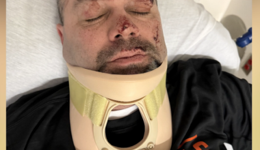 Longtime Bengals season ticket holder says he was attacked after home game