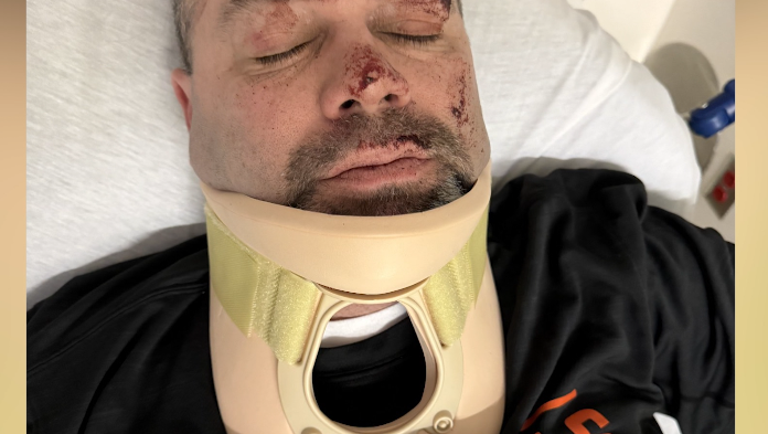 Longtime Bengals season ticket holder says he was attacked after home game