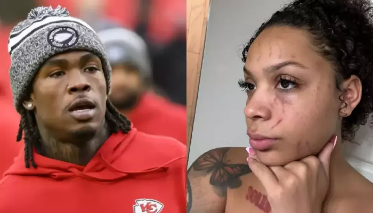 Rashee Rice Accused Of Domestic Abuse By Ex-GF, Dacoda Nichole, Was Chiefs Aware Of The Allegations?