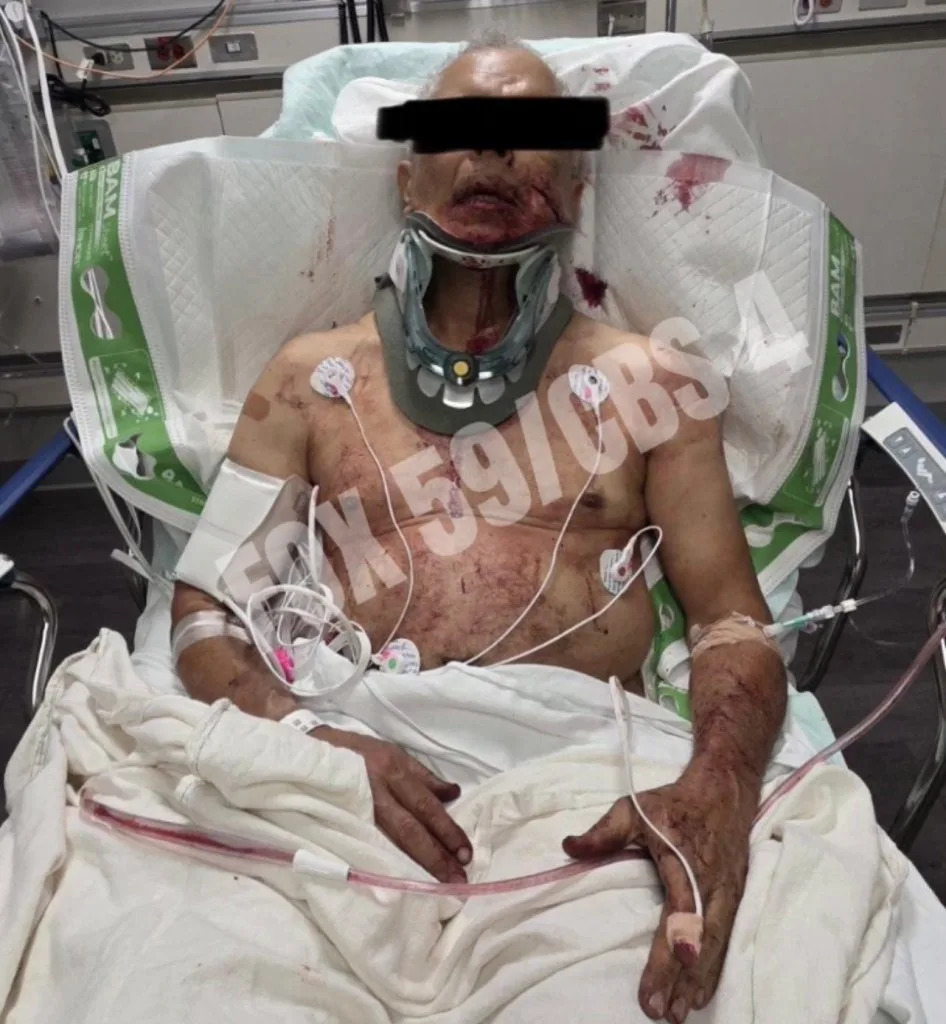 An unidentified person involved with the stabbing of former quarterback Mark Sanchez is seen in a photo obtained by FOX59. FOX59