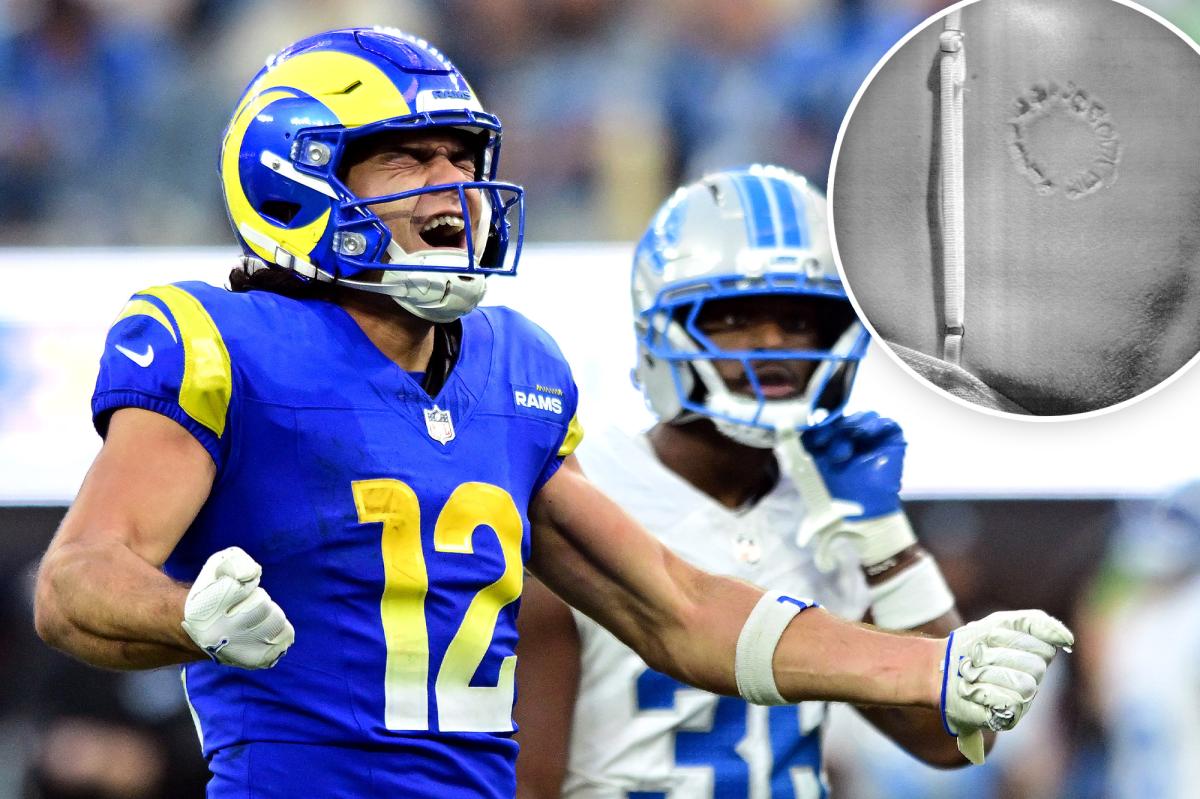 LA prosecutors investigating Puka Nacua biting allegations