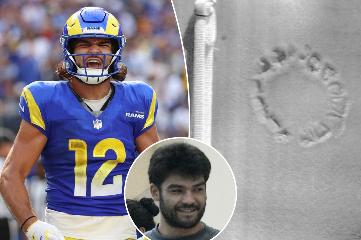 Puka Nacua checks into Malibu rehab after alleged New Year's Eve bite