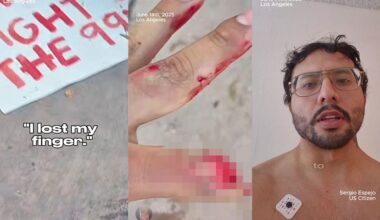 LA man sues LASD, alleging flashbang injury at "No Kings protest" led to amputation