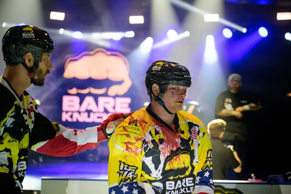 Yeah, that one's going to need some stitches. (RGBTV Photography)