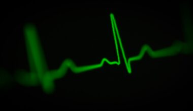 Toronto Maple Leafs @ Ottawa Senators